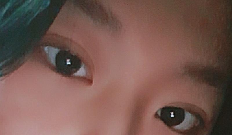 아직 붓기가 많아서 몰겟는데 난 그래두 만족스러워 ㅎ 쌩얼이기두 하구 ㅎ 눈화장하고 원래 뷰러하면 무쌍이라 티도안나서 못했는데 뷰러랑 마스카라도