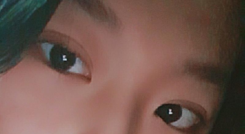 아직 붓기가 많아서 몰겟는데 난 그래두 만족스러워 ㅎ 쌩얼이기두 하구 ㅎ 눈화장하고 원래 뷰러하면 무쌍이라 티도안나서 못했는데 뷰러랑 마스카라도