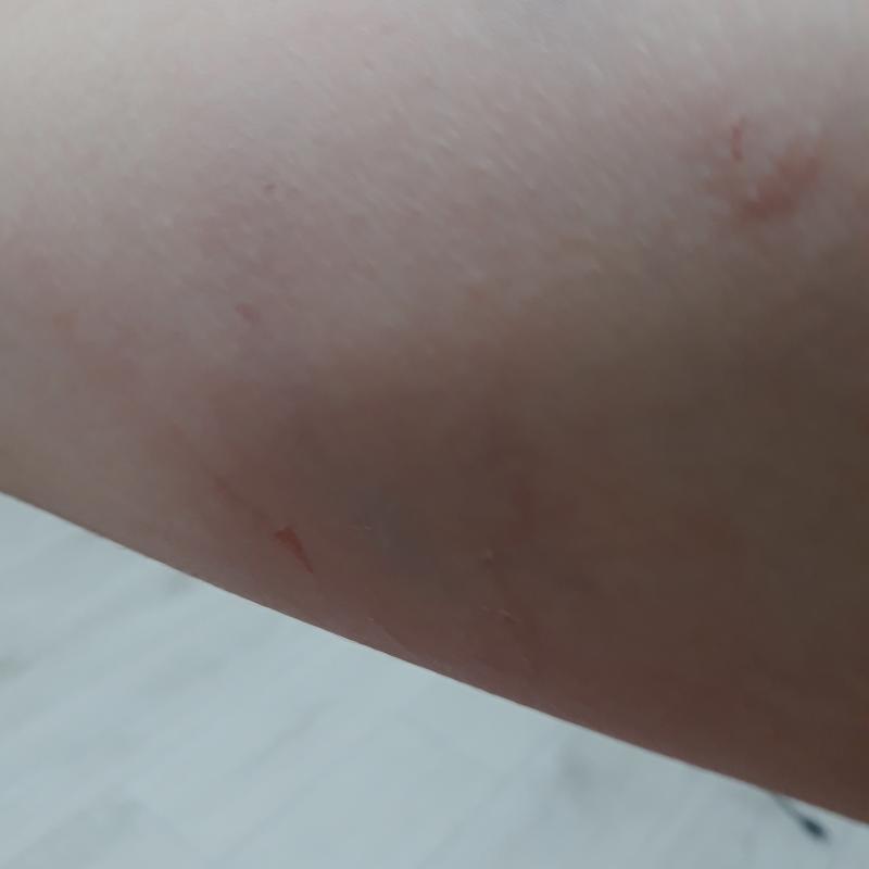 그리고 그때 생긴 상처들