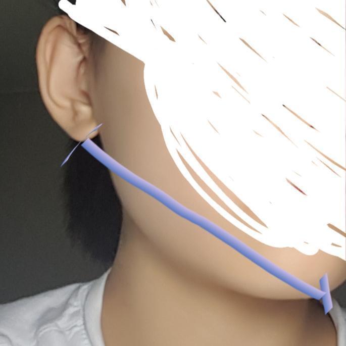 귓볼에서 턱 중앙까지의 길이 다르다는거 작년에 치과로 교정상담중에 처음 알았음 ;;