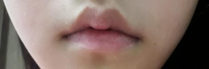 후면카메라라 좌우가 바뀐건지 설명을 잘못할 건지는 모르겠는데 대충이래.. 어릴때 그 입술 반대로 꼬는거? 그거 많이해서 그런지 이렇ㄱ0 되더라.