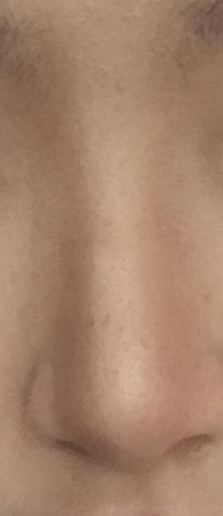 피부 약간 드럽다ㅠㅜㅠㅠ