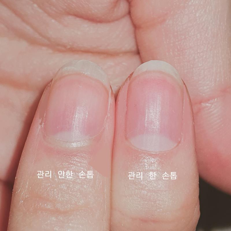 >>25 볼지는 모르겠지만 어쨌든 시간이 좀 흘러서 인증하러 왔어! 빡세게 관리를 한게 아니라 바디가 막 길진 않았고ㅜ 대신 모양이 길쭉하게 잡