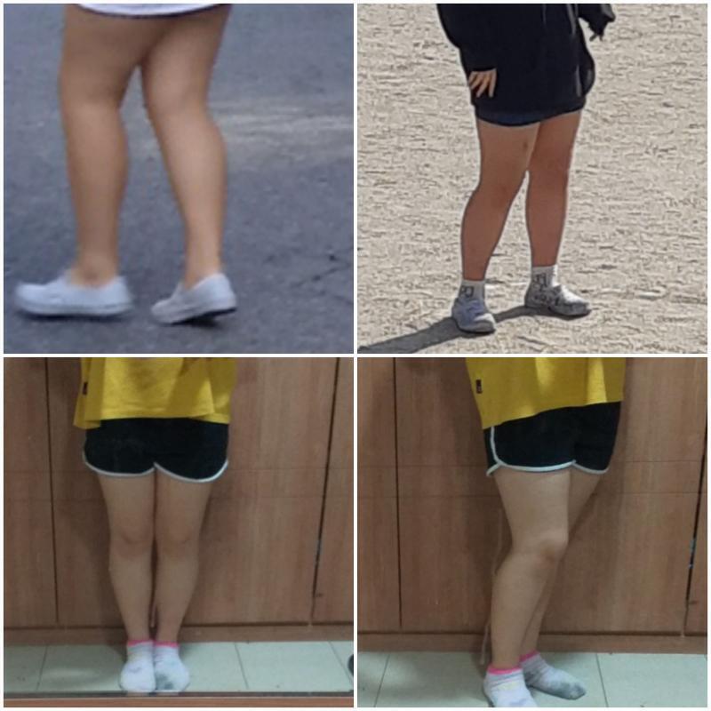 후