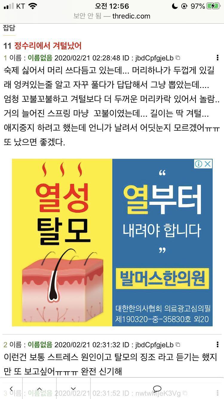이거 뭐냐...탈모광고 니가 넣었어? ㅋㅋㅋㅋㅋㅋ