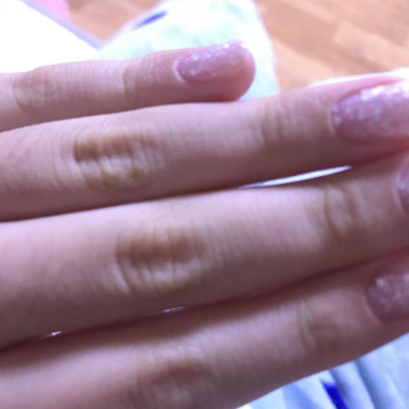 나 잔주름 엄청 심해ㅠㅠㅠ 중삼이야