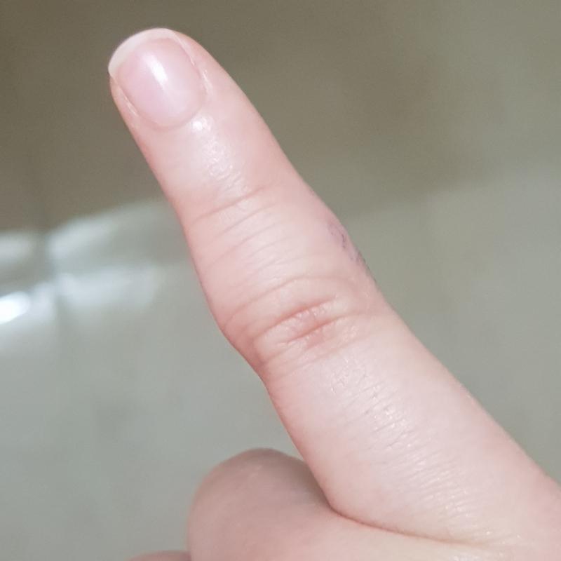 여기