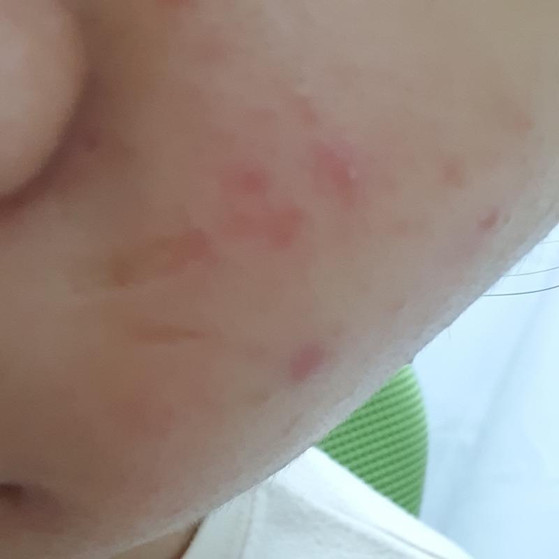 볼이얌..