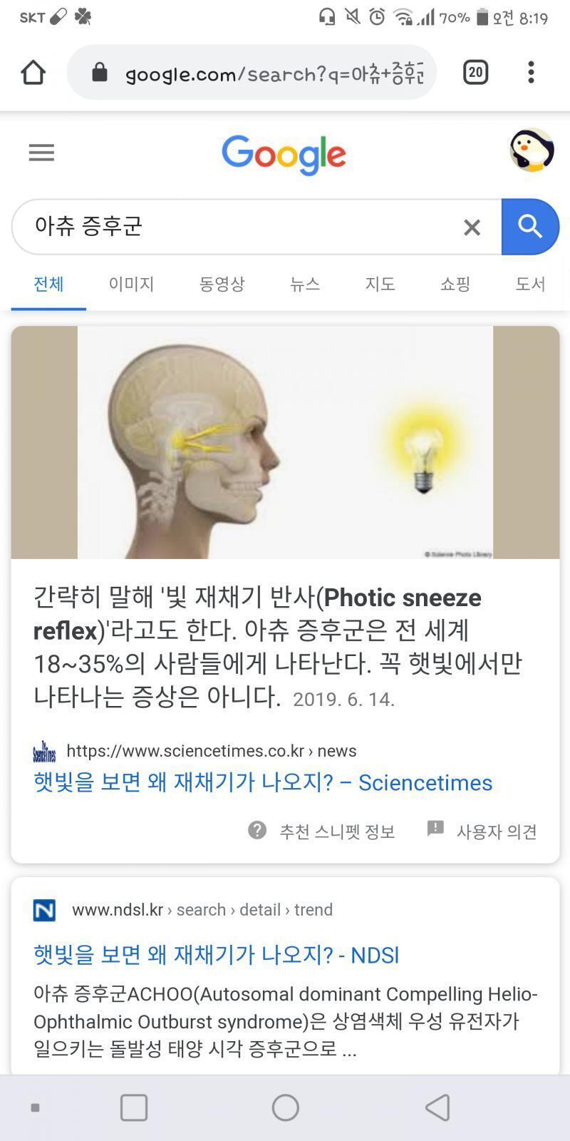 나 이것도 있어서 여름에 밖에나갈때마다 재채기하는데 지금 시국이 이모냥인데 사람들이 나 이상하게 생각하면 어떡해 여름쯤이면 끝나있겠지...??