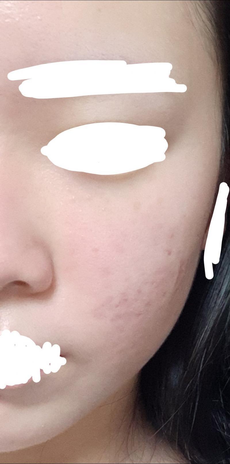 이건 파란색잠옷입고 자기전 조명안받을때 받앗을때