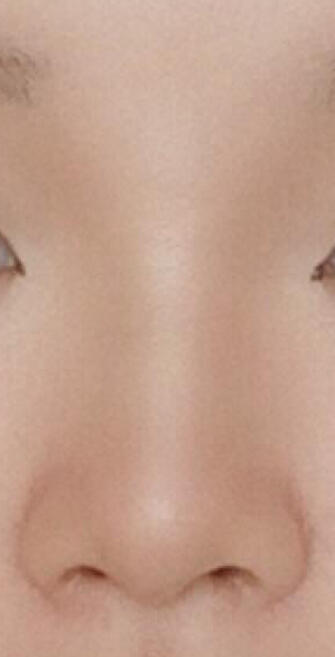 뺨