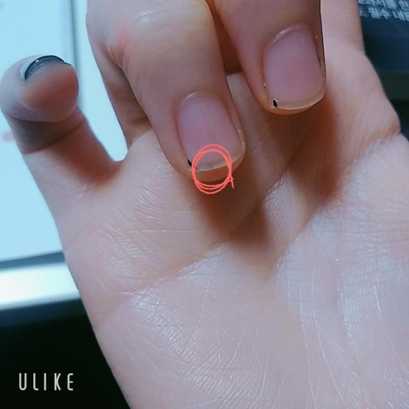 저 검은 건 아직 지우다가 만 거야..! 핑크색으로 동그라미 친 부분이 문제의 그거..