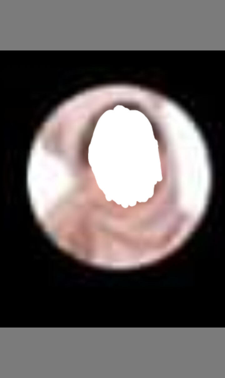 다른사람 프사 캡쳐하고 얼굴은 확실히 가렸는데 문제 없겠지..?