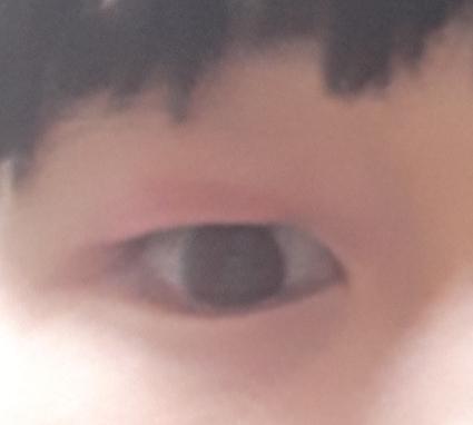 일단 이게 내 눈이야 이 레스 두번째 눈으로 내가 원하는 쌍꺼풀 만들려면 어디에 붙여야하는지 색칠해줘