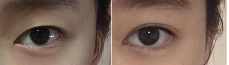 >>4 ㄴㄴ 이게 얼굴 전체를 봤을때 진짜 분위기가 확 달라지더라 가끔 쌍커풀 없을때 애들이 누구냐고 놀림ㅋㅌㅋㅋㅋㅋ 난 정말 눈이 얼굴 하드캐