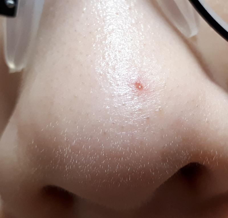 ㅜㅜ