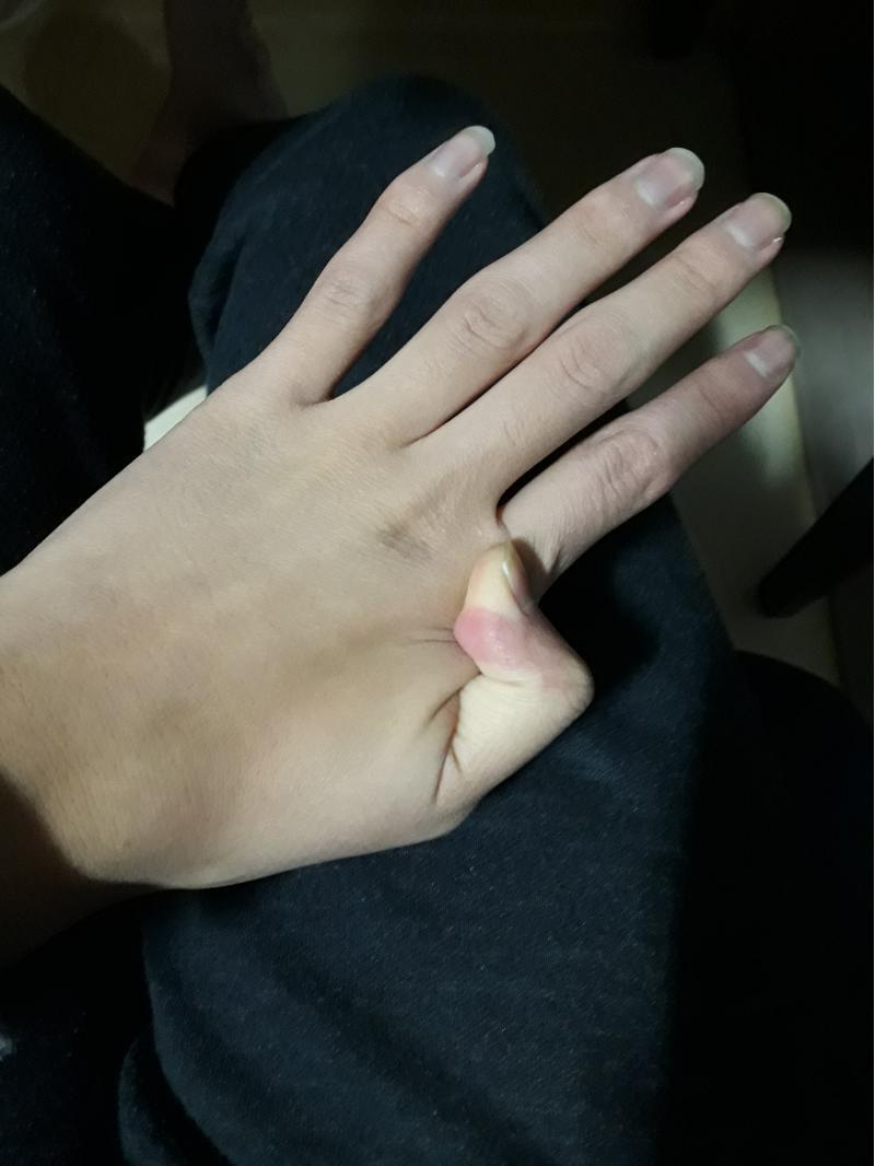 손가락 이렇게 할 수 있음