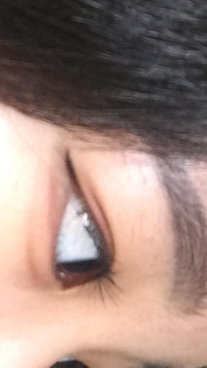 아잇