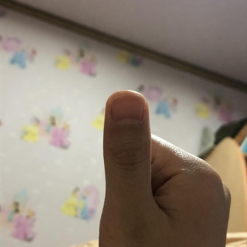 스레준데 내 손가락 ㅋㄱㅋㄱㅋㄱㅋㄱㅋㄱㅋㄱㅋㄱㅋㄱㅋㄱㅋㄱㅋㄱㅋㅋㄱㅋㄱㅋ 근데 스레 올리고 이렇게 많이 댓글 달릴지 몰랐엉...ㅋㅋㅋㅋ