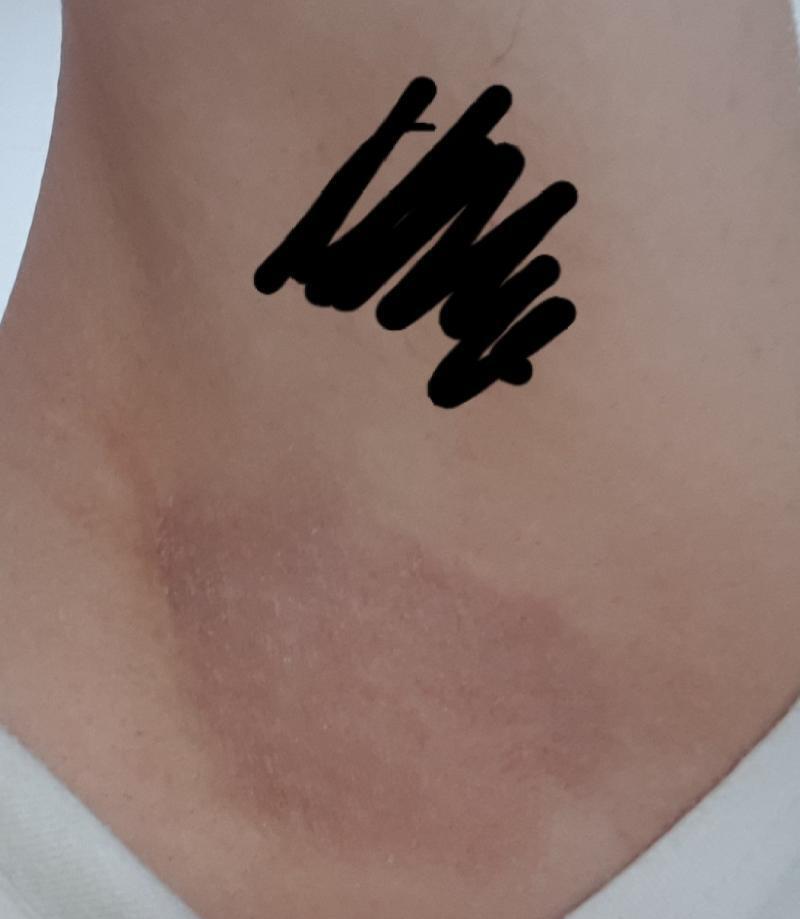 목아니구 겨드랑이 인데 혹시 좀 불편한 사람들은 보지 않았으면 해 털은 가리긴 햇지만..!