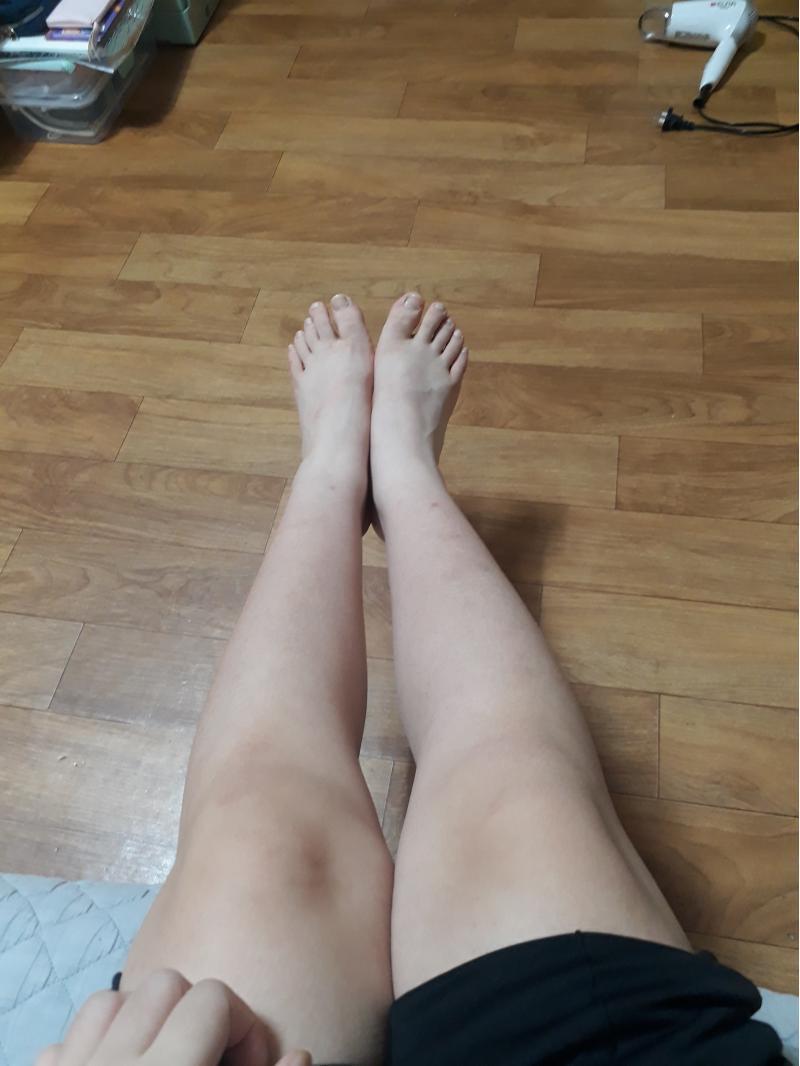 올림