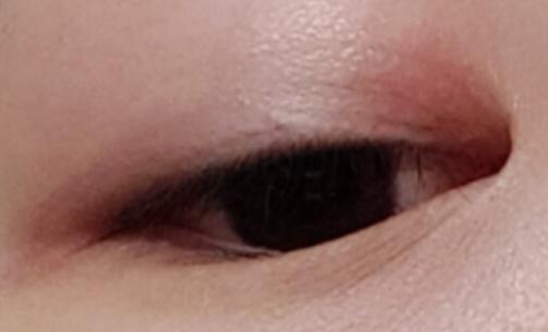 사진 첨부할게! 좀 거북할 수도 있을 것 같다 미안