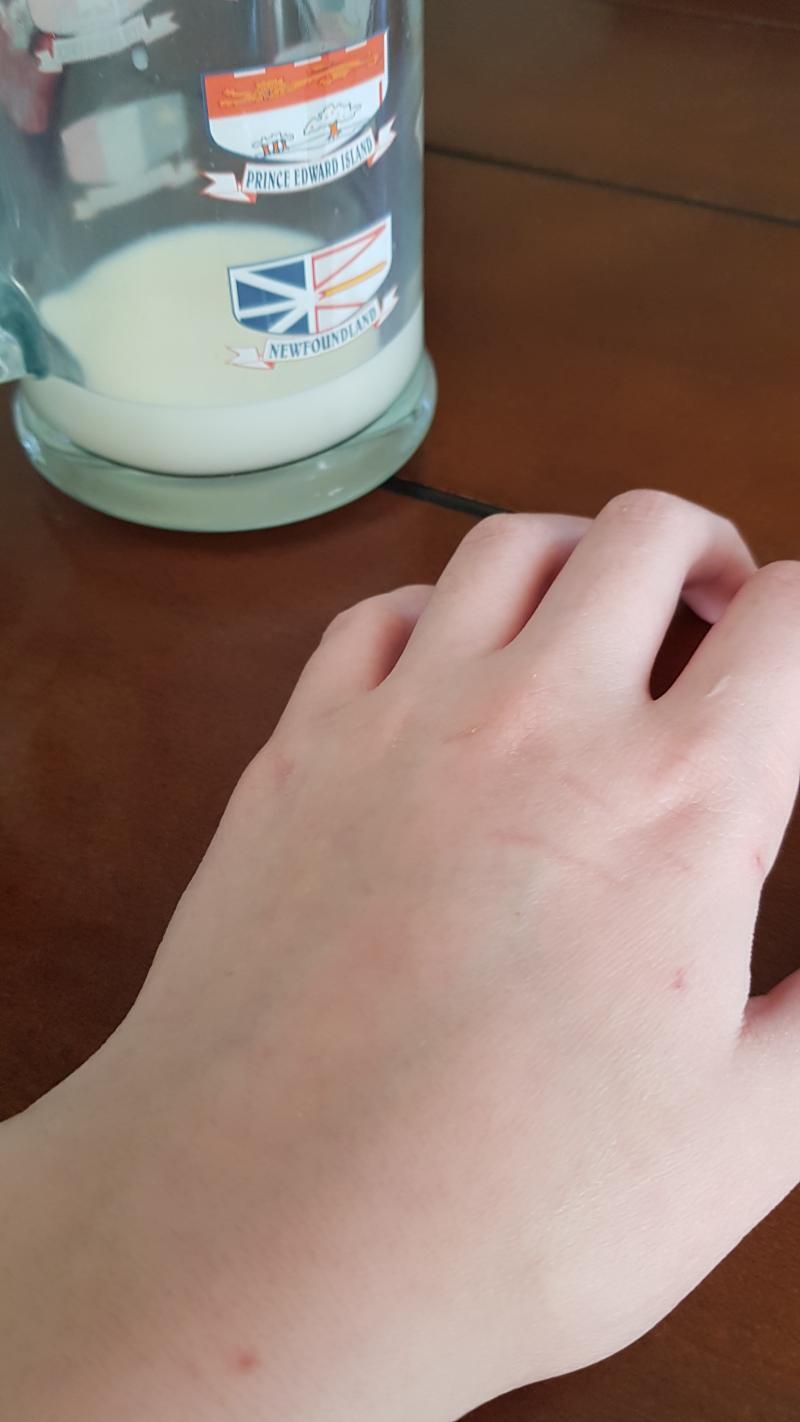 이게 한달동안 난 기스다. 분명 기스났는데 시간흘러서 지워진것도 있겠지.