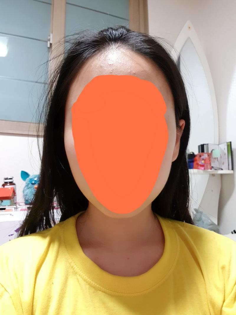이상?