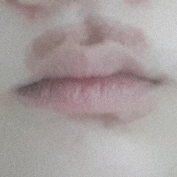 ㅅㅂ..... 남친 없다 저거 오래갈거가태??? 입술 아래도 생긴거임..... 둥글게둥글게..