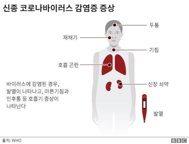 만약 진짜 나 걸렸다면 큰 일 날 것 같네...ㅎㅎ 안 그래도 신장 안 좋은데 더 안 좋아진다니... 일주일 정도 기다려보고 증상 계속되면 병원
