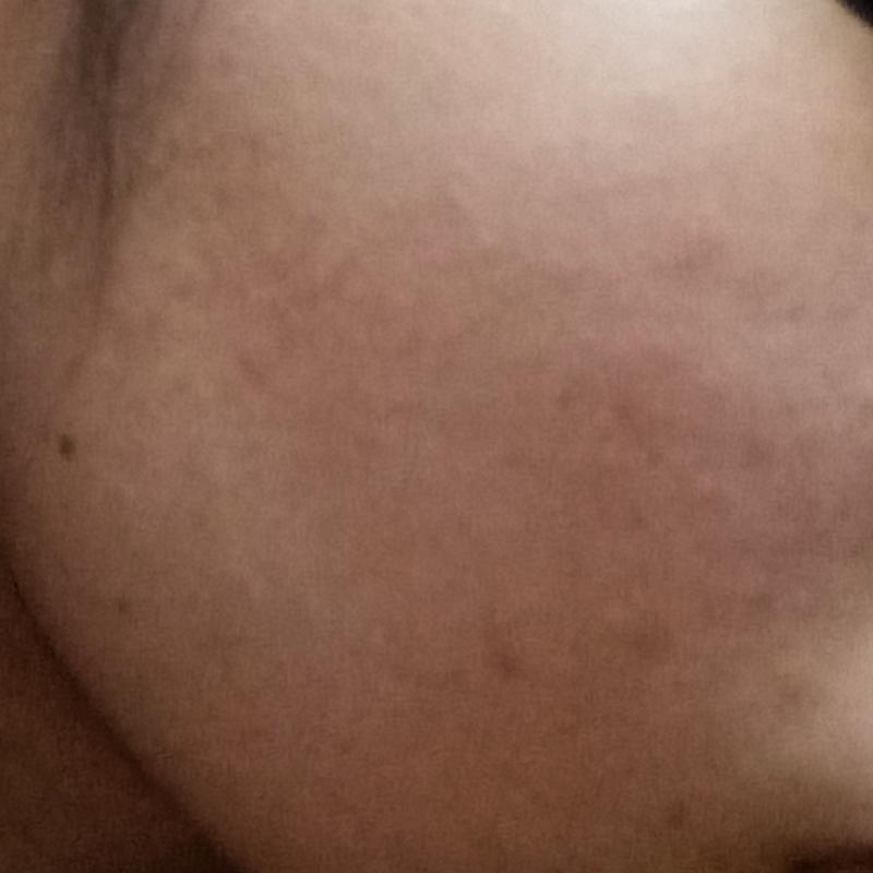사진이 수ㄴ서대로 올라갔을지는 모르겠는데 점있는사진이 왼쪽볼이고 그 옆에가 오른쪽볼 머리카락라인 보이는 사진이 이마야 +초경을 초3때 해서인지 