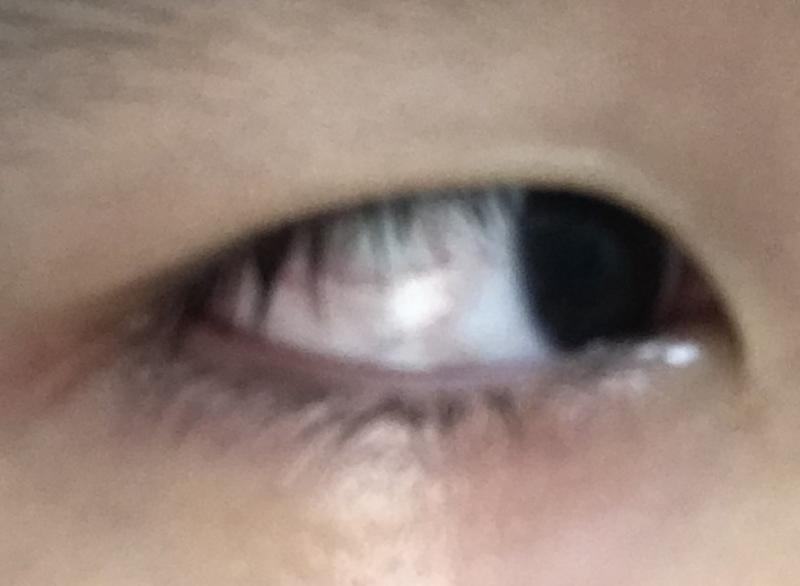##########징그러움 주의##########