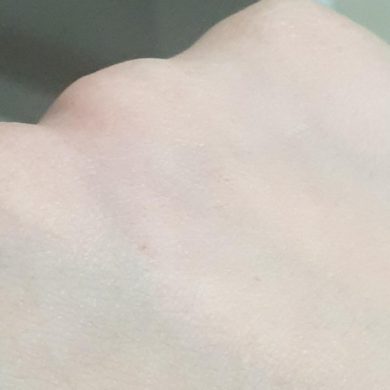 저 빨간 점 같으 게 물린 데인거 같기도 하구