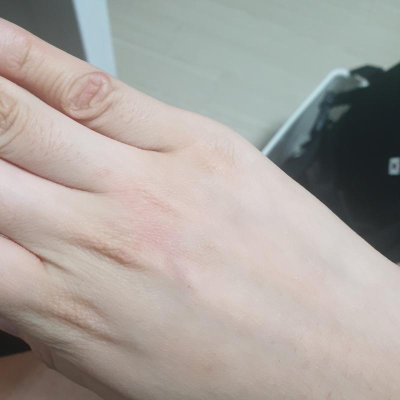 저 빨간 점 같으 게 물린 데인거 같기도 하구