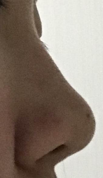 후