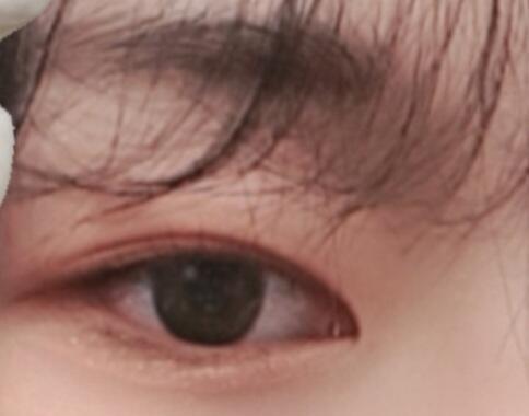 오른쪽 눈이야