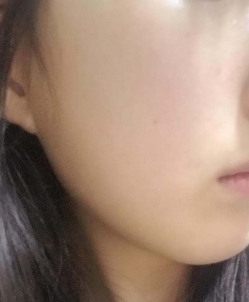 노멀카메라로 찍음 지금 내 피부상태야!! 남들이 봤을때 안좋을수도 있긴한데 내가 보기엔 엄청 좋은거라고 생각해… 아니면 미안해!!!