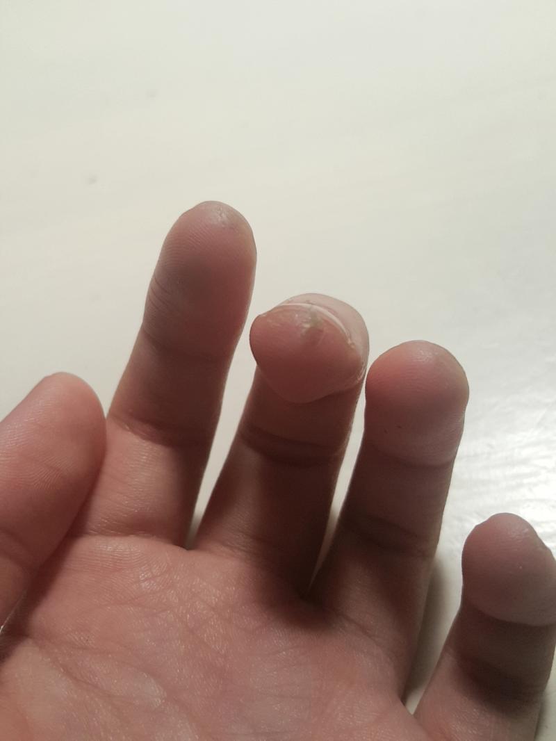 이거 어떻게 뜯어야 안 아플까...