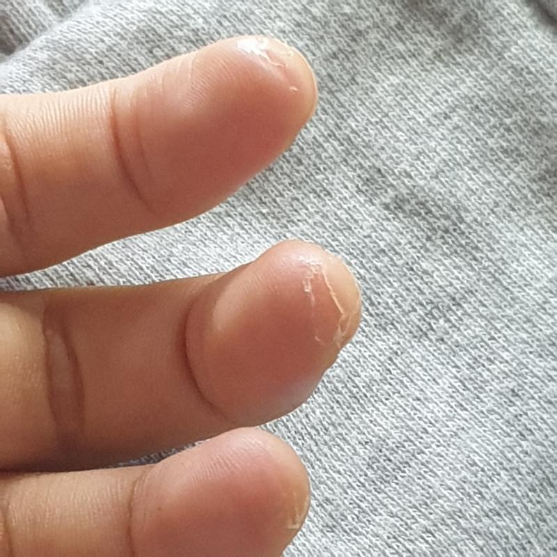 근데 생각보다 기타치면 손 상태 많이심각하거든 지금 샤워한게 아니라서 그렇지만 샤워한번하면 진짜 심하게 막 까져....물론 코드잡는손은 왼손이고