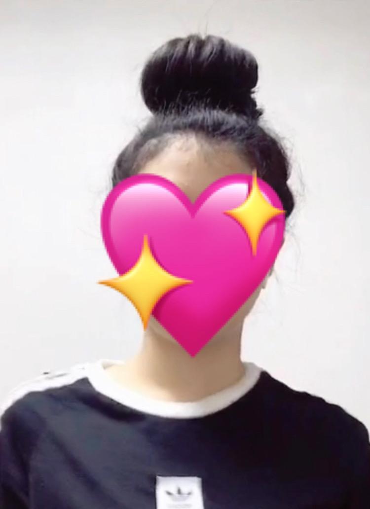 >>6 정수리에 똥만들면 이렇게 되는데 ㄱㄴ..?