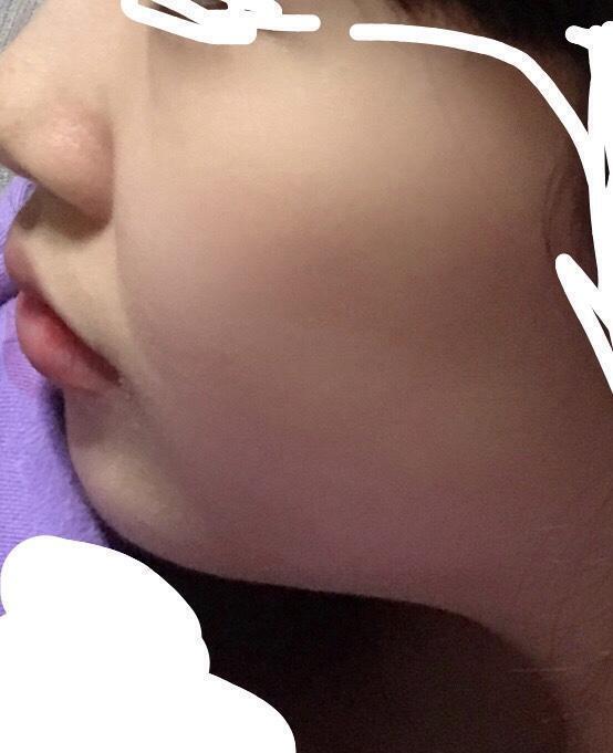 ㅁ