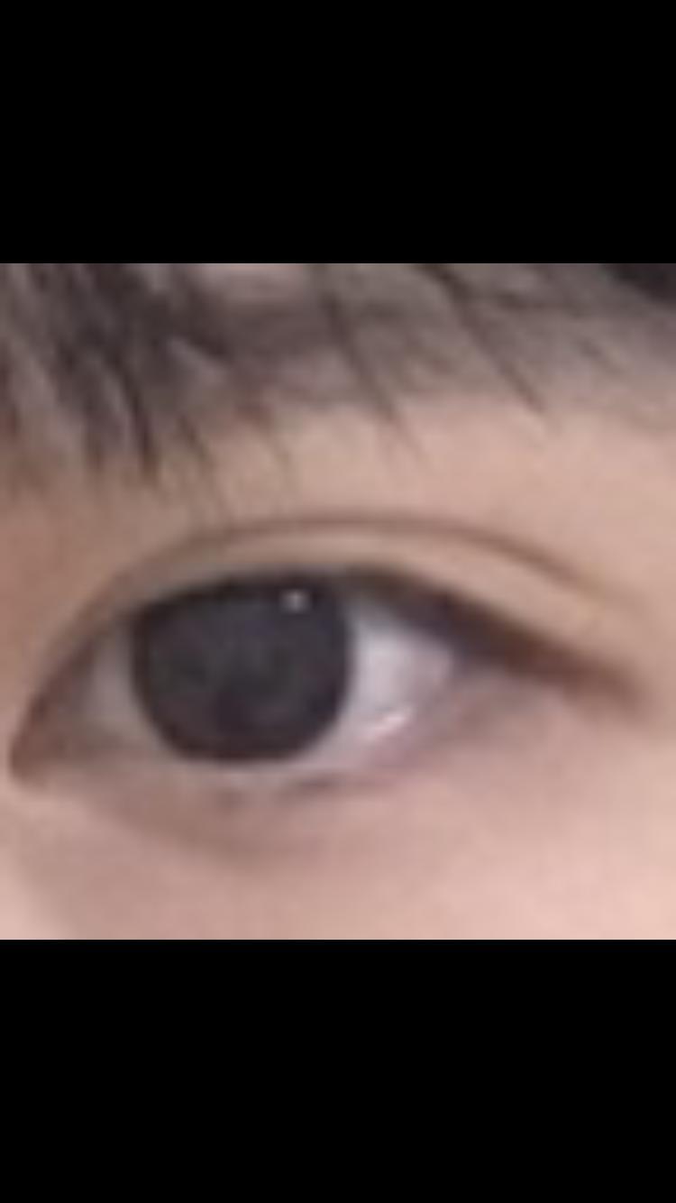 눈