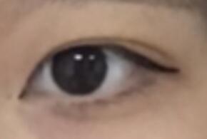 눈
