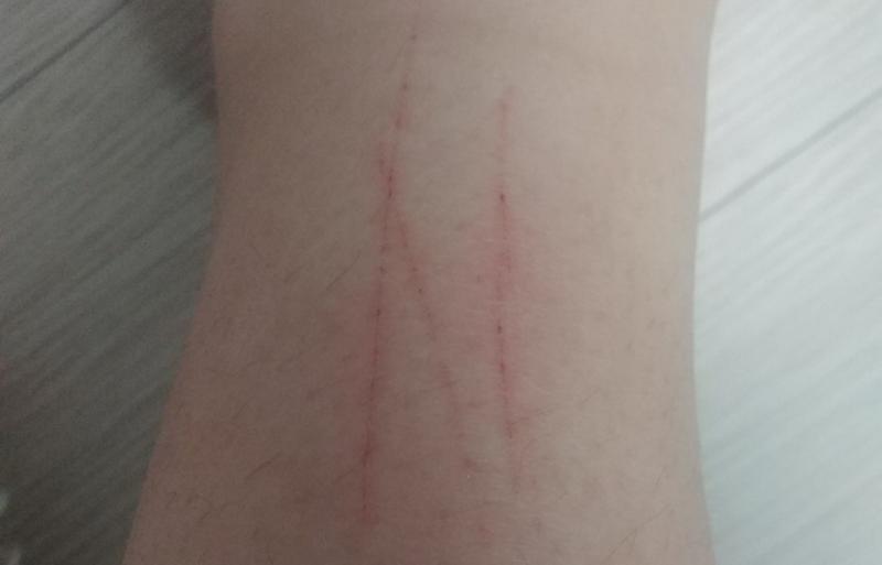 이건 혹시나 싶어서 올려보는 아침에 찍었던 상처 사진인데 뭐 별 게 있지는 않는 것 같고... 뭔가 짐작가는 게 있다면 공유 좀 부탁한다
