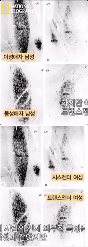 >>12 너무 신기하다!! 동영상 봤더니 이성애자 남성이랑 시스젠더 여성의 뇌 사진이 똑같고 동성애자 남성과 트랜스젠더 여성의 뇌 사진이 똑같던