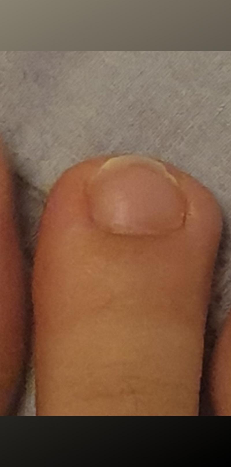 내 발가락 이렇게 네모 아님..