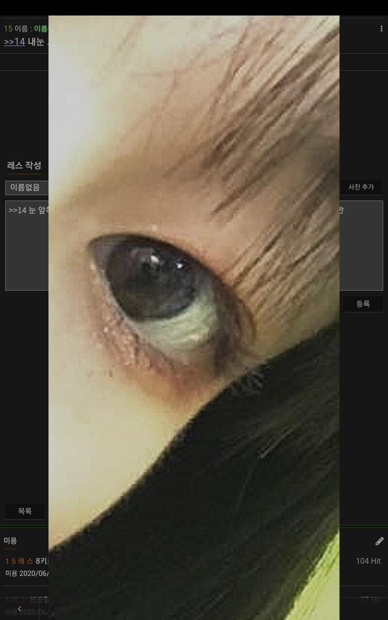 >>14 눈 앞쪽은 워낙 뒷쪽들보다 살이 많아 나도 그래 ~ 한 1년 앞은 없고 뒤만 있게 해서 이렇게 완성됐던 때가 있었어! 앞은 없고 뒤만