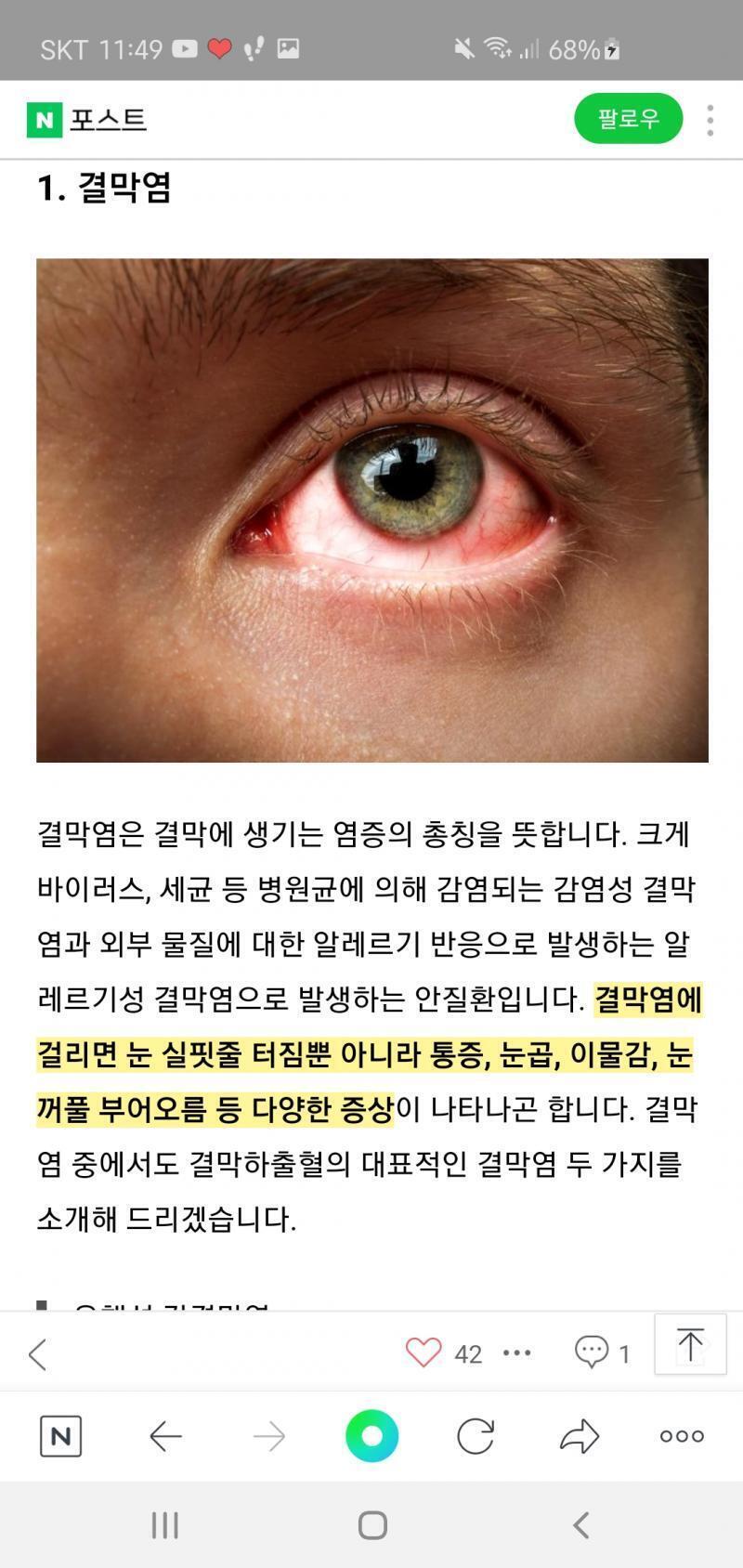 >>13 사진 올려줄게!읽어봐