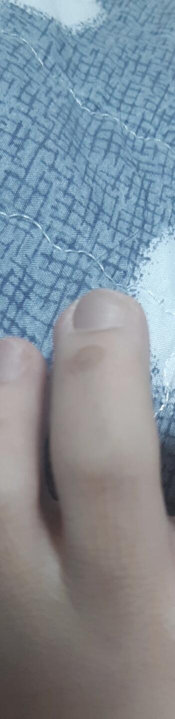 음...난 구두 오래 신어서 두번째 발가락 각각 물집 크게 잡혀서 그대로 뒀더니 굳은살?같이 남았더라구(사진 첨가) 그리고 나 중3때 한 5월달