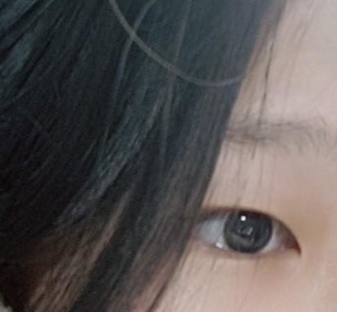 원래 눈이고 최근 쌍수한 눈 ㅎㅎㅎ나 올 1월에 쌍수핶당 ㅎㅎ이쁘게 잘 된거같아ㅋㅋ난 견적은 앞트임 쬐끔,지방제거,절개법으로 수술했어ㅋ그리고,나